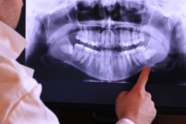Best Emergency Dental Surgery in New Concord, OH