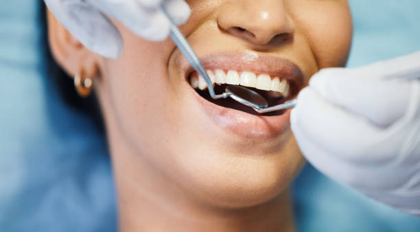 Best Emergency Root Canal Treatment in New Concord, OH